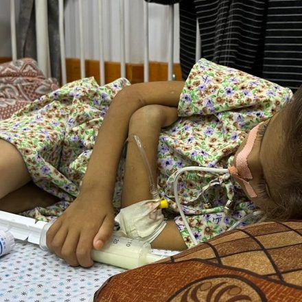 A child is treated for malnutrition at the Patient Friends Benevolent Society hospital in Gaza City on May 29, 2025.