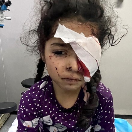 A 6-year-old Palestinian girl after an eye removal operation at European Hospital near Khan Younis, Gaza. Shrapnel and a 2- to 3-inch stone hit her left eye after the bombing of a building next to the makeshift shelter she was living in with her family. According to Dr. Yasser Khan, her father died and her mother was injured in an Israeli attack.